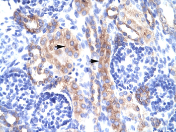RORA Rabbit Polyclonal Antibody