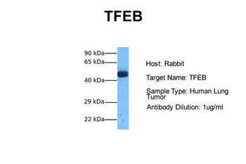 TFEB Rabbit Polyclonal Antibody
