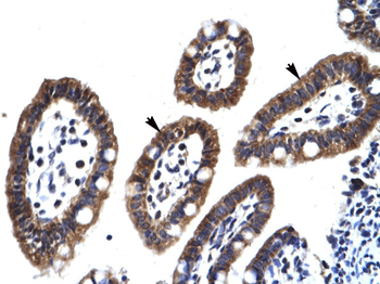 EGR2 Rabbit Polyclonal Antibody