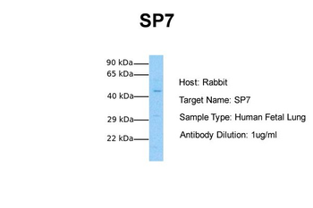 SP7 Rabbit Polyclonal Antibody