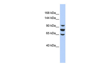 EPC1 Rabbit Polyclonal Antibody