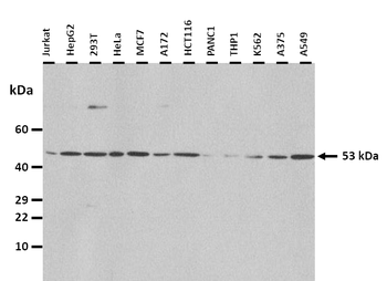 AGT Rabbit Polyclonal Antibody
