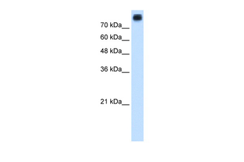 CDH3 Rabbit Polyclonal Antibody