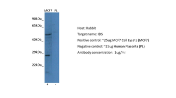 IDS Rabbit Polyclonal Antibody