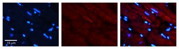 TFRC Rabbit Polyclonal Antibody