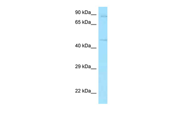 TFRC Rabbit Polyclonal Antibody