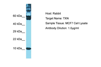 TXN Rabbit Polyclonal Antibody