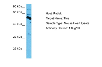 THRA Rabbit Polyclonal Antibody