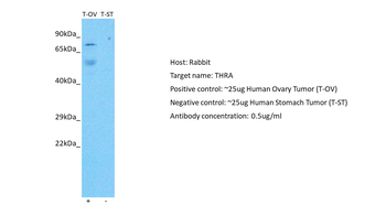 THRA Rabbit Polyclonal Antibody