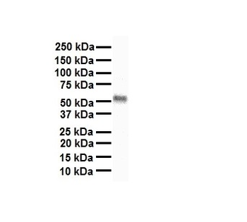 THRA Rabbit Polyclonal Antibody