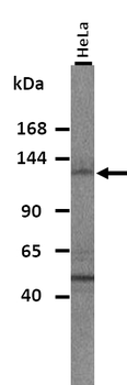 L1CAM Rabbit Polyclonal Antibody