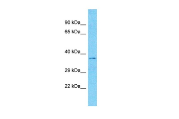 MARCH5 Rabbit Polyclonal Antibody