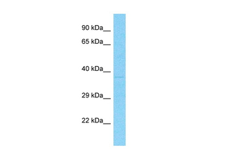 MARCH5 Rabbit Polyclonal Antibody