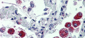 CY24B Rabbit Polyclonal Antibody