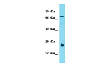 PROSER3 Rabbit Polyclonal Antibody