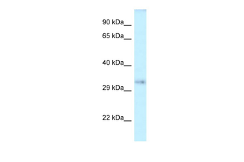 SEPT12 Rabbit Polyclonal Antibody