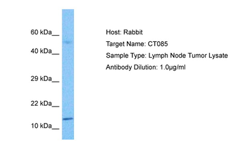 C20ORF85 Rabbit Polyclonal Antibody
