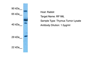 MTRF1L Rabbit Polyclonal Antibody