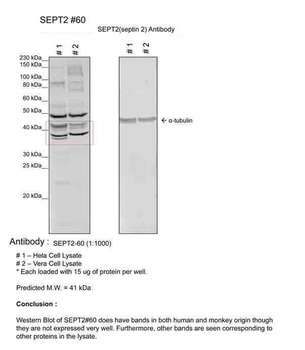 SEPT2 Rabbit Polyclonal Antibody