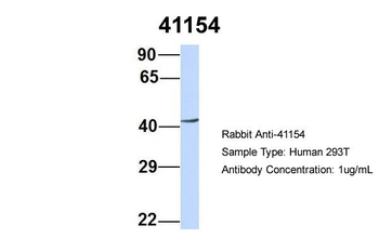 SEPT2 Rabbit Polyclonal Antibody