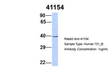 SEPT2 Rabbit Polyclonal Antibody