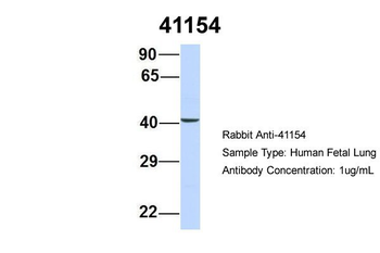 SEPT2 Rabbit Polyclonal Antibody