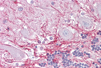 RP2 Rabbit Polyclonal Antibody