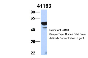 SEPT11 Rabbit Polyclonal Antibody