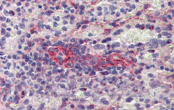 SEPT11 Rabbit Polyclonal Antibody