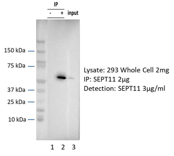 SEPT11 Rabbit Polyclonal Antibody