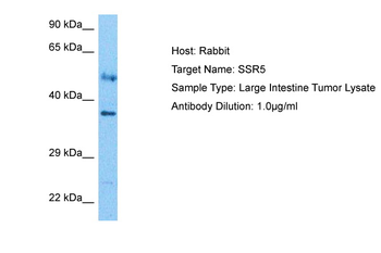 SSR5 Rabbit Polyclonal Antibody
