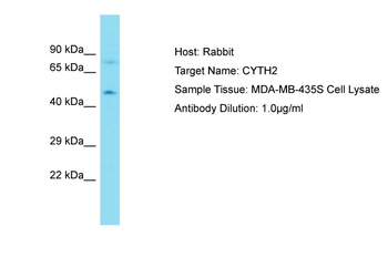 CYTH2 Rabbit Polyclonal Antibody