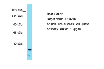 WASHC2A Rabbit Polyclonal Antibody