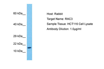 RAC3 Rabbit Polyclonal Antibody