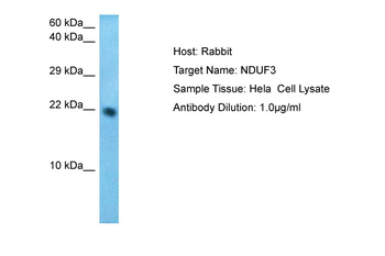 NDUFAF3 Rabbit Polyclonal Antibody