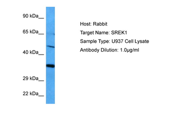 SREK1 Rabbit Polyclonal Antibody