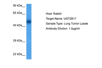 UGT2B17 Rabbit Polyclonal Antibody