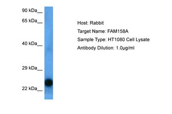 EMC9 Rabbit Polyclonal Antibody