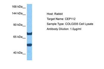 CEP112 Rabbit Polyclonal Antibody