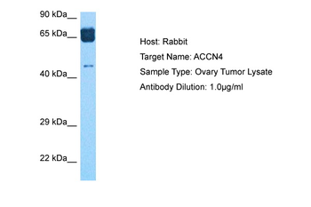 ASIC4 Rabbit Polyclonal Antibody