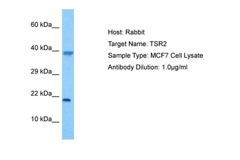 TSR2 Rabbit Polyclonal Antibody