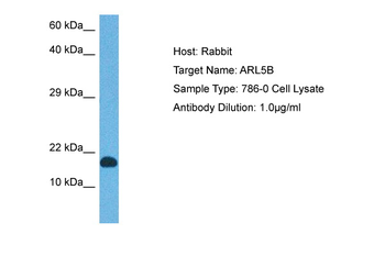 ARL5B Rabbit Polyclonal Antibody