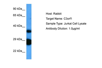 TIMMDC1 Rabbit Polyclonal Antibody