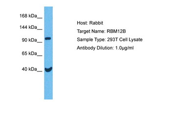 RBM12B Rabbit Polyclonal Antibody
