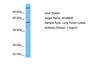 ACSM2B Rabbit Polyclonal Antibody