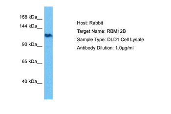 RBM12B Rabbit Polyclonal Antibody