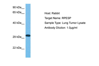 SBSPON Rabbit Polyclonal Antibody
