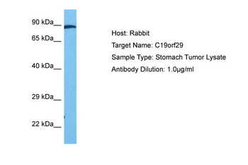 CACTIN Rabbit Polyclonal Antibody