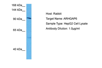 ARHGAP6 Rabbit Polyclonal Antibody