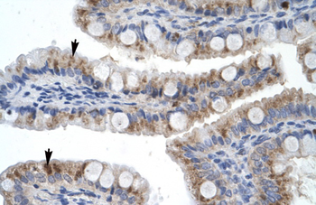 ZNF341 Rabbit Polyclonal Antibody